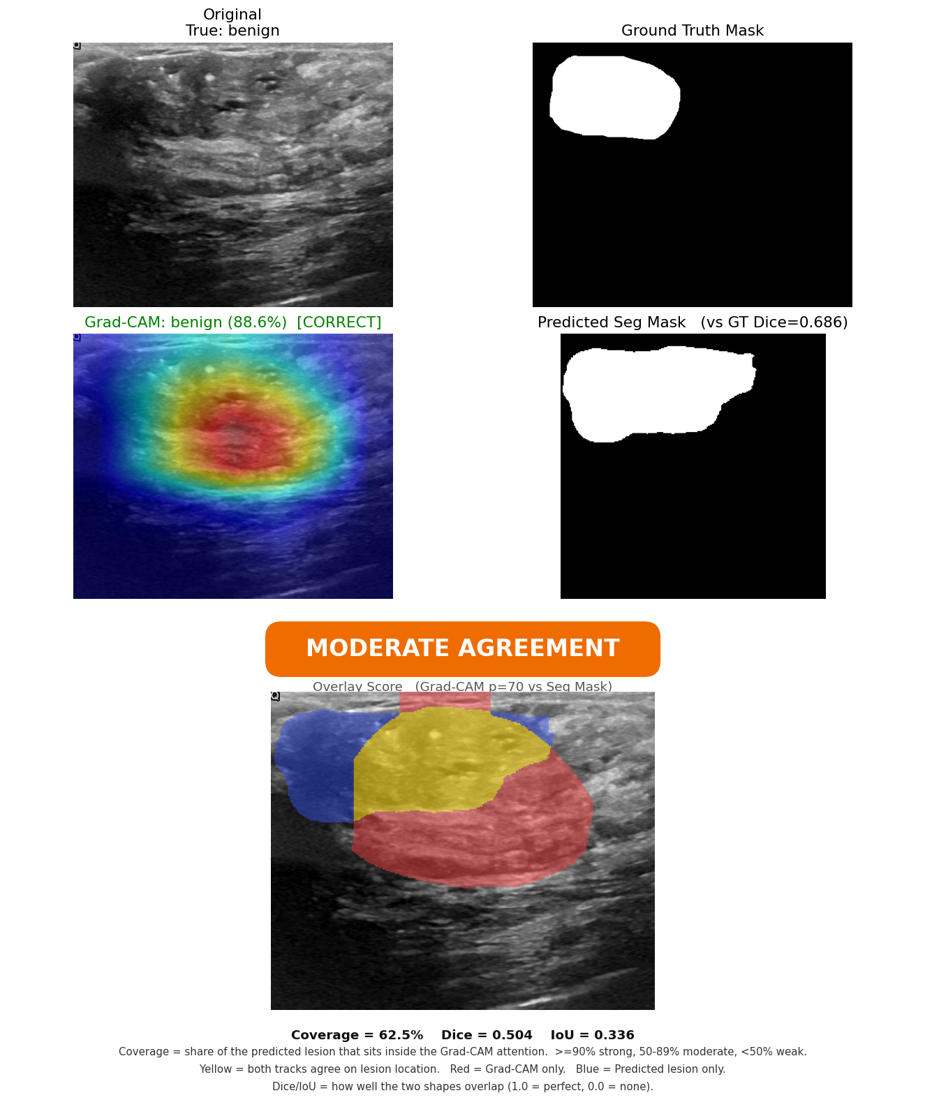 Moderate agreement case