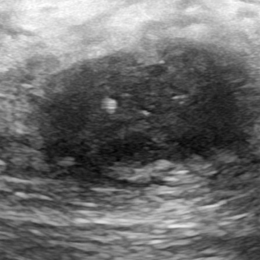 Input ultrasound image